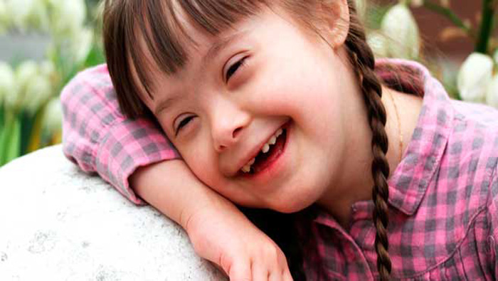 El Síndrome de Down es la discapacidad intelectual y la alteración genética humana más común.