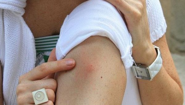 Las autoridades sanitarias recomiendan evitar picadas de mosquito
