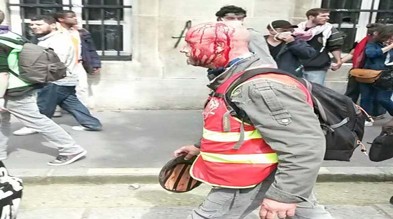 Tras ser víctima de represión policial, un hombre huye por las calles de París con el rostro ensangrentado. 