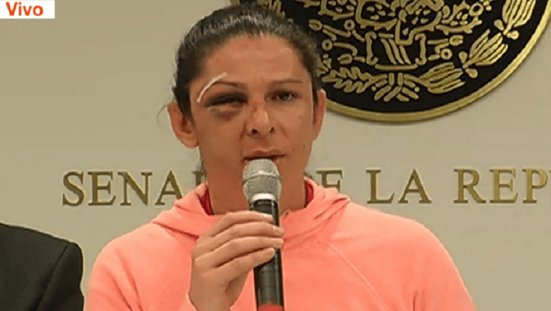 Ana Guevara, gloria de deporte y diputada mexicana, es otro caso de agresión contra mujeres.