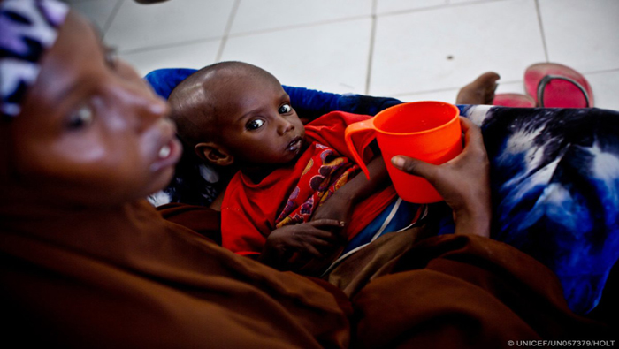 Cerca de un millón y medio de menores está en riesgo inminente de muerte por desnutrición aguda, según cifras de la Unicef.