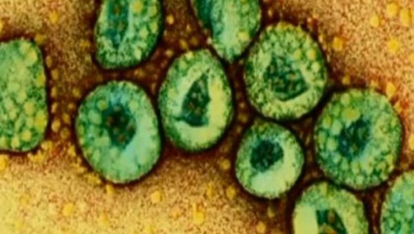 El virus MERS fue detectado por primera vez en Arabia Saudí en 2012(Foto:Archivo)