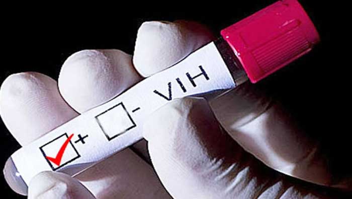 La OMS destaca la reducción en la propagación del VIH en África