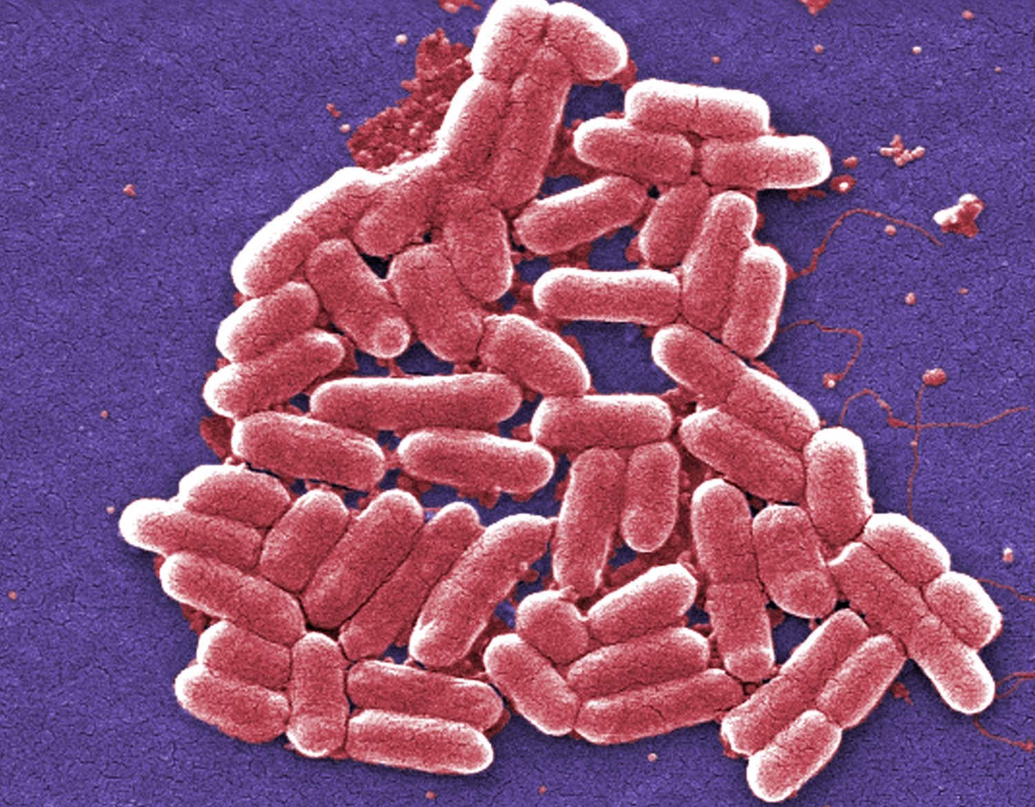 Especialistas temen que sea el anuncio de una generación de superbacterias.