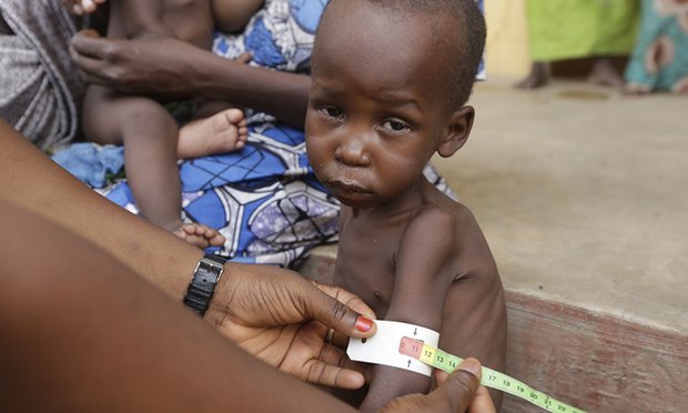 La mayoría de las personas que padecen de desnutrición en Nigeria son niños, advierte la ONU.