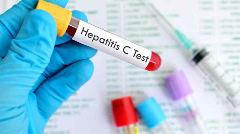 Solo 20 por ciento de los infectados con hepatitis C conocen su afección.