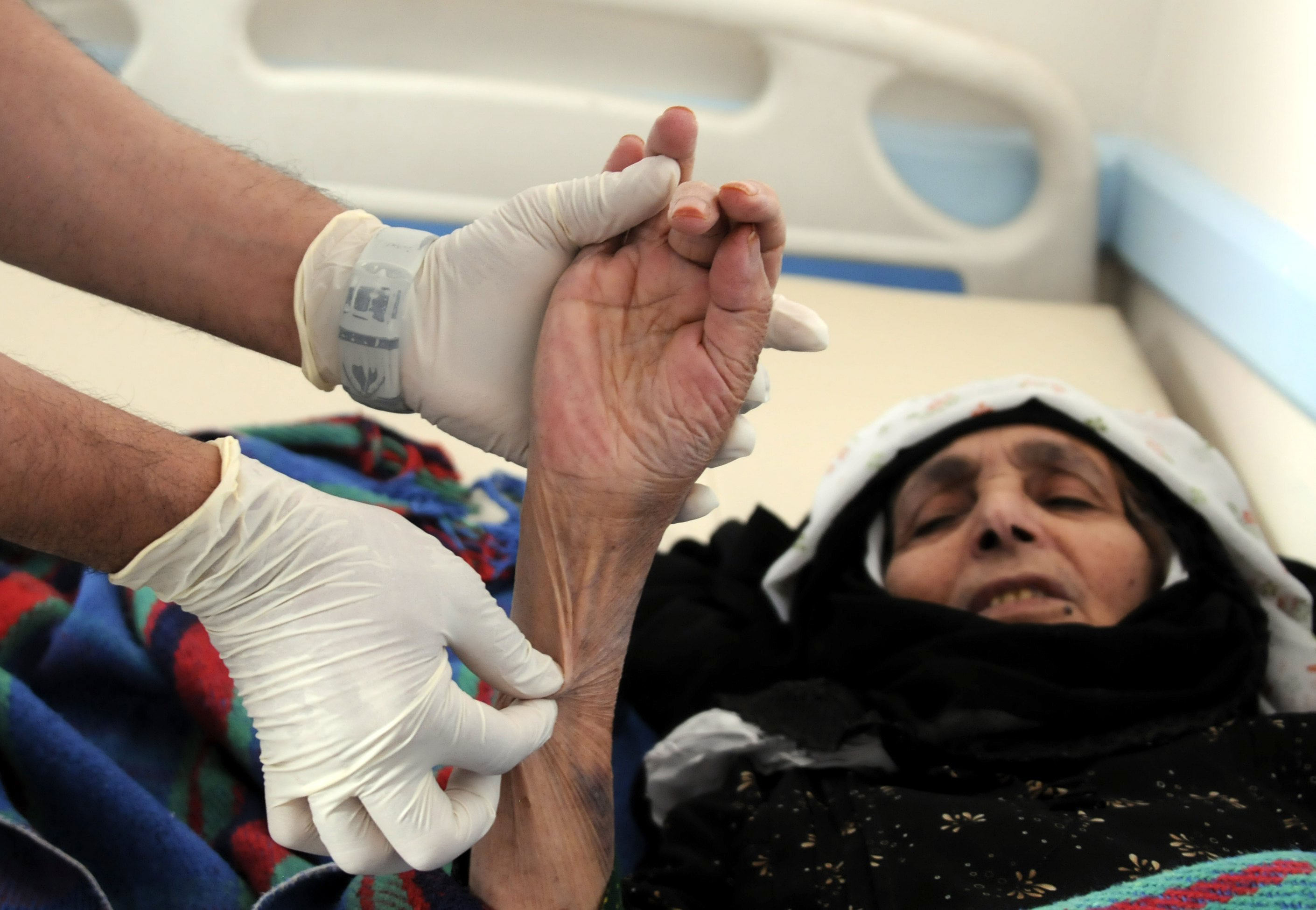 La OMS presentó un balance de los afectados por el brote de cólera en Yemen a partir de abril de 2017.