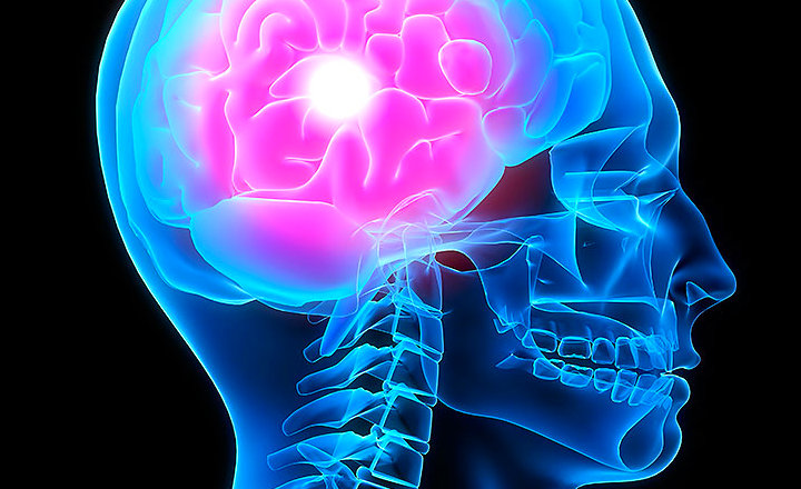 En el 50 por ciento de los casos no tratados el padecimiento deja daños cerebrales o provoca la muerte.