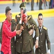 “Disparen contra Venezuela”: la doble vara y después