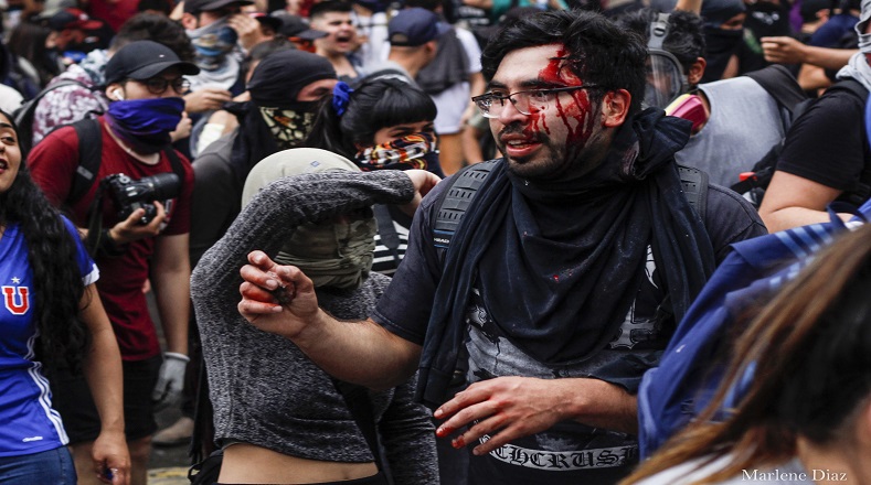 Manifestante herido en la cabeza por una bomba lacrimógena (Santiago de Chile, 20 de octubre 2019).