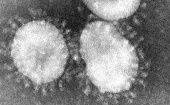 Hasta el momento, Brasil es el único país de Sudamérica que ha confirmado presencia de coronavirus. 
