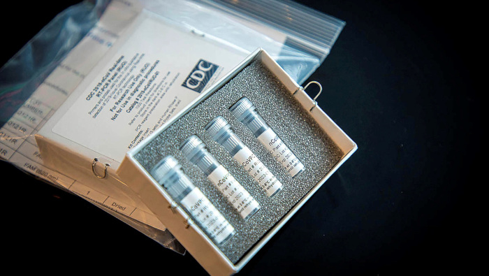 En la imagen aparece un kit de prueba de laboratorio para el coronavirus - síndrome respiratorio agudo grave (SARS-CoV-2).