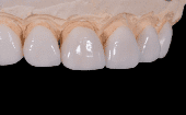  "Estos hallazgos cambian toda nuestra comprensión del origen de los dientes", señaló uno de los autores del estudio.