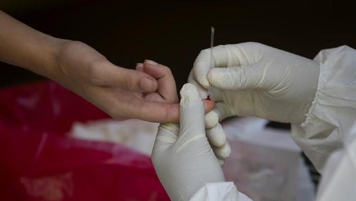 La OMS ha identificado la aplicación de pruebas de diagnóstico como uno de los cuatro pilares del enfoque integral de enfrentamiento a la pandemia.